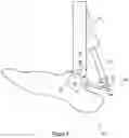 Fig. 04 - PROSTHETIC FOOT ASSEMBLY