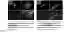 Fig. 02 - Non-woven graft materials for nerve repair and regeneration