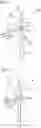 Fig. 02 - WIND TURBINE OPERABLE IN A REVERSE MODE OF OPERATION AND CORRESPONDING METHOD OF OPERATING A WIND TURBINE