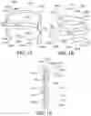Fig. 12 - Oral Treatment Device