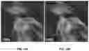 Fig. 10 - SYSTEMS AND METHODS FOR IMAGE PROCESSING