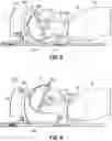 Fig. 06 - HEAD STABILIZATION SYSTEMS AND METHODS