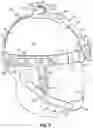 Fig. 07 - HEAD STABILIZATION SYSTEMS AND METHODS