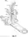 Fig. 17 - HEAD STABILIZATION SYSTEMS AND METHODS