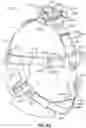 Fig. 52 - HEAD STABILIZATION SYSTEMS AND METHODS