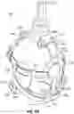 Fig. 57 - HEAD STABILIZATION SYSTEMS AND METHODS