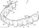 Fig. 01 - Methods and systems for locating marks on orthodontic appliances