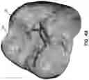 Fig. 06 - Methods and systems for locating marks on orthodontic appliances