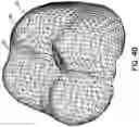 Fig. 07 - Methods and systems for locating marks on orthodontic appliances