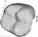 Fig. 08 - Methods and systems for locating marks on orthodontic appliances