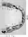 Fig. 20 - Methods and systems for locating marks on orthodontic appliances