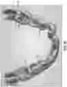 Fig. 22 - Methods and systems for locating marks on orthodontic appliances