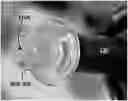 Fig. 01 - TRANSDUCER PROBES FOR OPHTHALMOLOGICAL INSTRUMENTS AND USES THEREOF