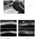 Fig. 04 - TRANSDUCER PROBES FOR OPHTHALMOLOGICAL INSTRUMENTS AND USES THEREOF