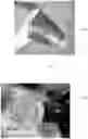 Fig. 09 - TRANSDUCER PROBES FOR OPHTHALMOLOGICAL INSTRUMENTS AND USES THEREOF