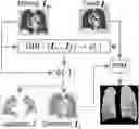 Fig. 01 - Context-aware volumetric style transfer for estimating single volume surrogates of lung function