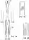 Fig. 02 - DEVICES, SYSTEMS AND METHODS FOR IMPROVING SUCTION IN MEDICAL PROCEDURES