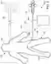Fig. 04 - DEVICES, SYSTEMS AND METHODS FOR IMPROVING SUCTION IN MEDICAL PROCEDURES