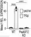 Fig. 01 - Regulating Activation of Fibroblasts to Prevent Fibrosis