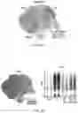 Fig. 05 - Regulating Activation of Fibroblasts to Prevent Fibrosis