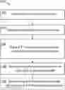 Fig. 01 - MACHINE LEARNING-SUPPORTED PIPELINE FOR DIMENSIONING AN INTRAOCULAR LENS