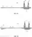 Fig. 06 - DILATION DEVICE AND METHOD OF USE