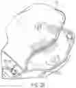 Fig. 15 - DEVICES AND METHODS FOR NEGATIVE PRESSURE THERAPY