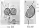 Fig. 29 - DEVICES AND METHODS FOR NEGATIVE PRESSURE THERAPY