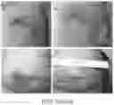 Fig. 35 - DEVICES AND METHODS FOR NEGATIVE PRESSURE THERAPY