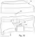Fig. 10 - Rotatable material transfer system with adjustment and related system components