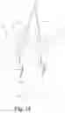 Fig. 31 - Hearing aid with voice recognition