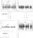 Fig. 76 - Hearing aid with voice recognition