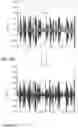 Fig. 77 - Hearing aid with voice recognition