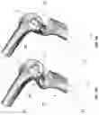 Fig. 02 - Ligament Modeling and Balancing