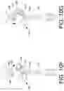 Fig. 45 - METHODS FOR DELIVERING AGENTS WITH PRE-FILLED SYRINGES TO MINIMIZE INTRAOCULAR INFLAMMATION