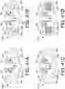 Fig. 85 - METHODS FOR DELIVERING AGENTS WITH PRE-FILLED SYRINGES TO MINIMIZE INTRAOCULAR INFLAMMATION