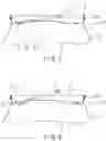 Fig. 04 - CAN LID