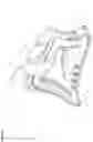 Fig. 09 - CANNULA FIXATION DEVICE