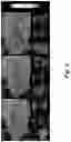 Fig. 09 - COMPOSITIONS OF ALUM NANOPARTICLES FOR IMMUNOMODULATION AND METHODS FOR PRODUCING THE SAME