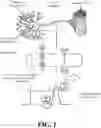 Fig. 02 - Detection and Treatment of Obstructive Sleep Apnea