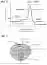 Fig. 03 - Detection and Treatment of Obstructive Sleep Apnea