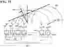 Fig. 07 - Detection and Treatment of Obstructive Sleep Apnea