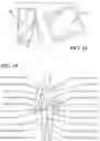 Fig. 09 - Detection and Treatment of Obstructive Sleep Apnea