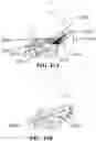 Fig. 33 - Detection and Treatment of Obstructive Sleep Apnea