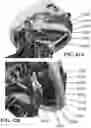 Fig. 34 - Detection and Treatment of Obstructive Sleep Apnea