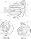 Fig. 07 - Linkage for improved diagnostics for kinematic assembly