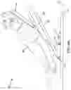 Fig. 10 - SYSTEMS AND METHODS FOR HEAD UP CARDIOPULMONARY RESUSCITATION