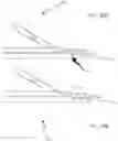 Fig. 41 - SYSTEMS AND METHODS FOR HEAD UP CARDIOPULMONARY RESUSCITATION