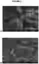 Fig. 02 - INJECTABLE HIGH CONCENTRATION PHARMACEUTICAL FORMULATIONS AND METHODS OF MANUFACTURING AND USE THEREOF