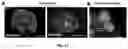 Fig. 07 - Multicompartement hydrogel fibre their preparation and uses thereof